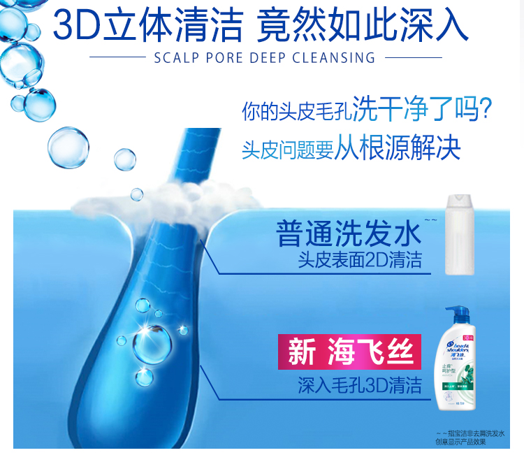 海飞丝洗发水止痒呵护750ml（持久去屑止痒清爽柔顺）-京东